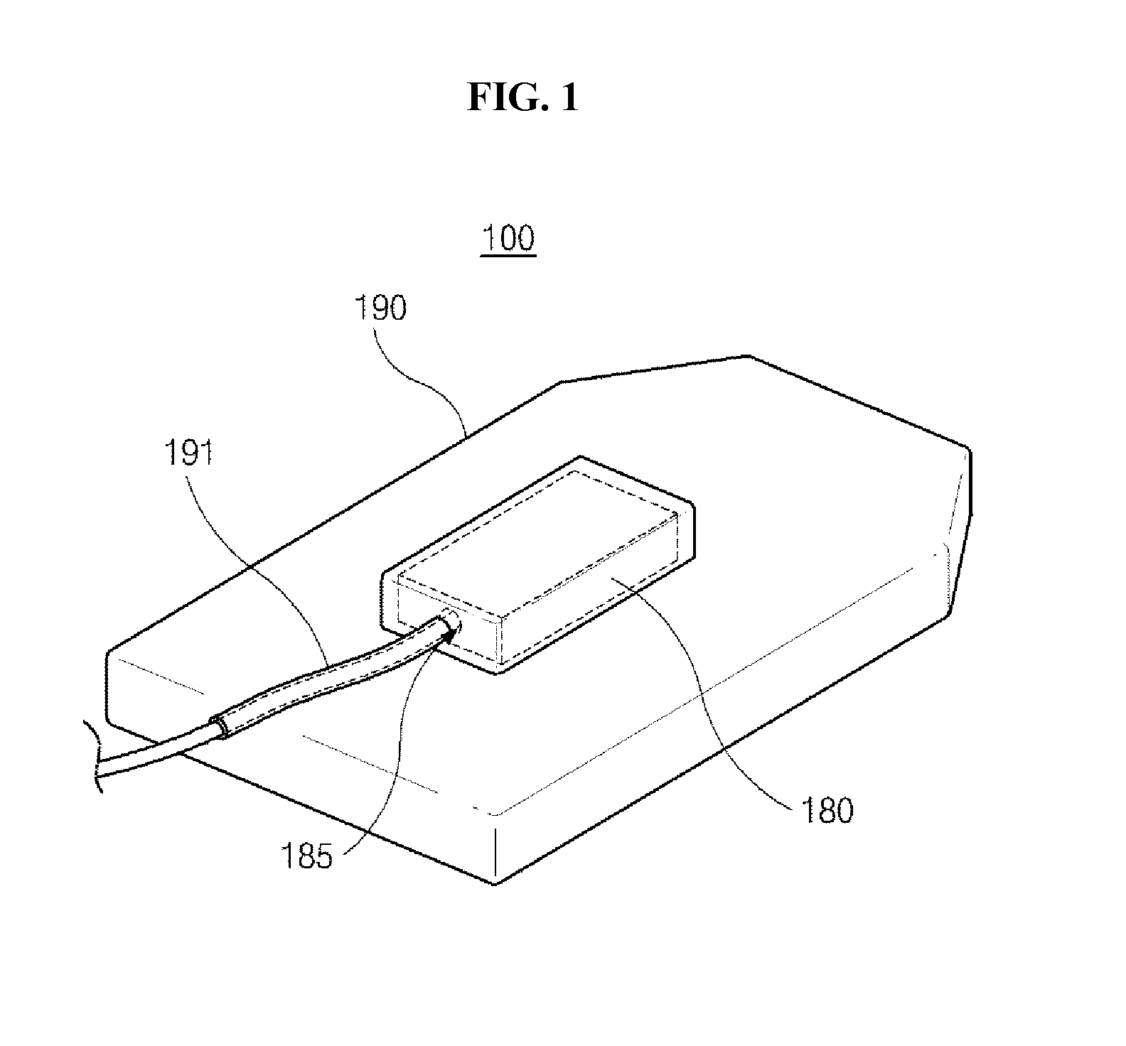 Intraoral sensor