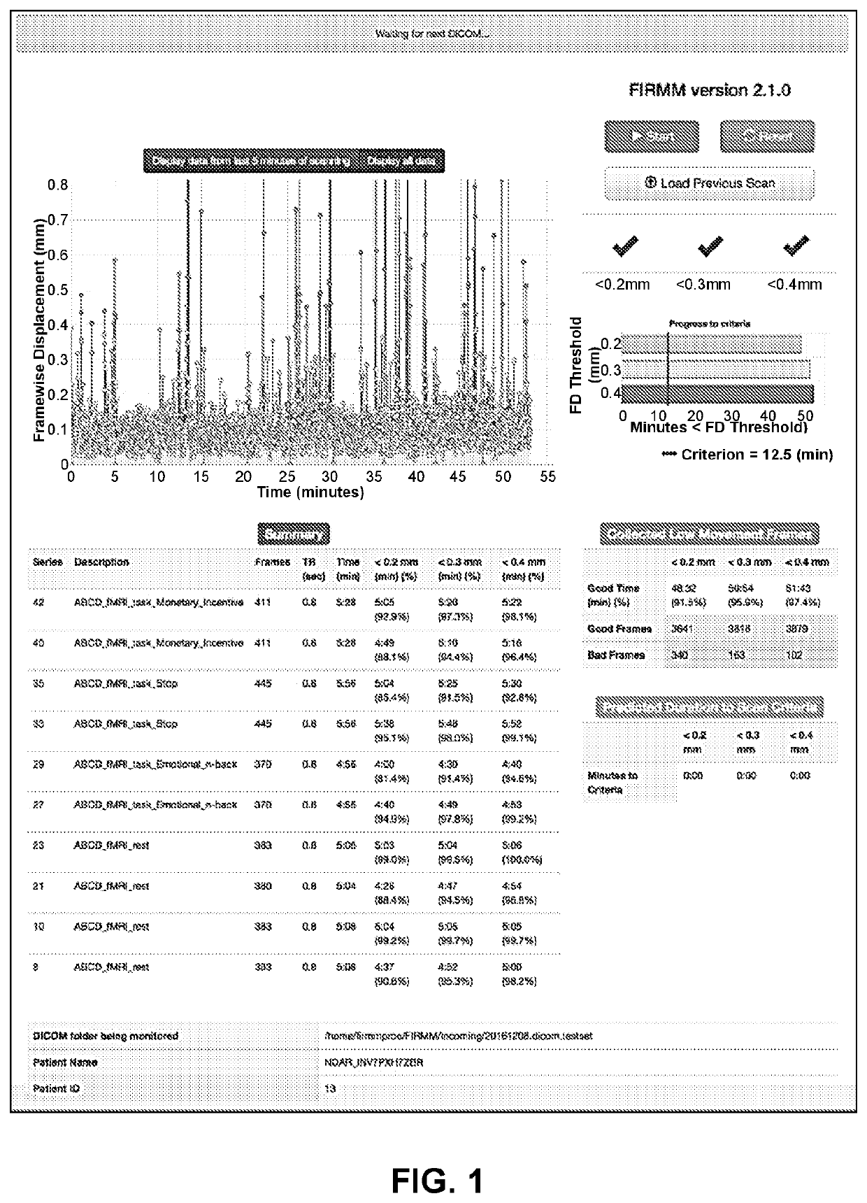 Real time monitoring and prediction of motion in MRI