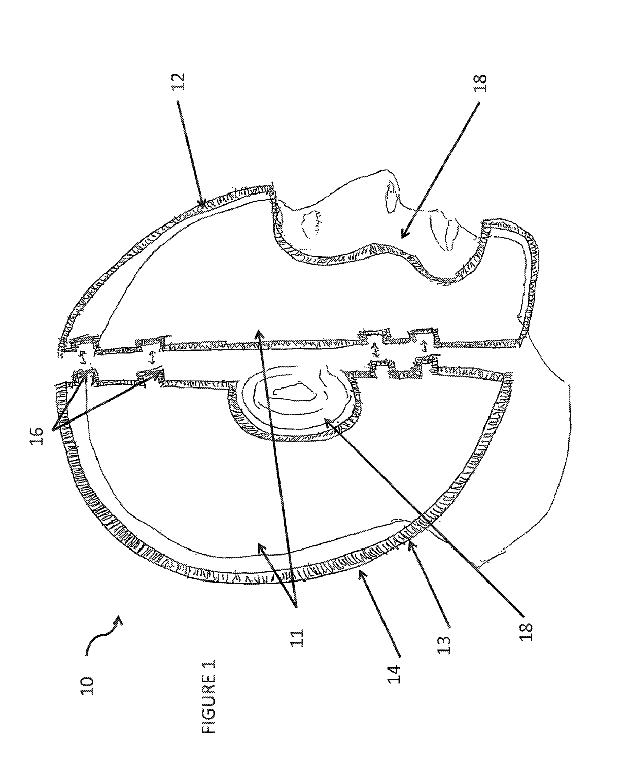 Total contact helmet