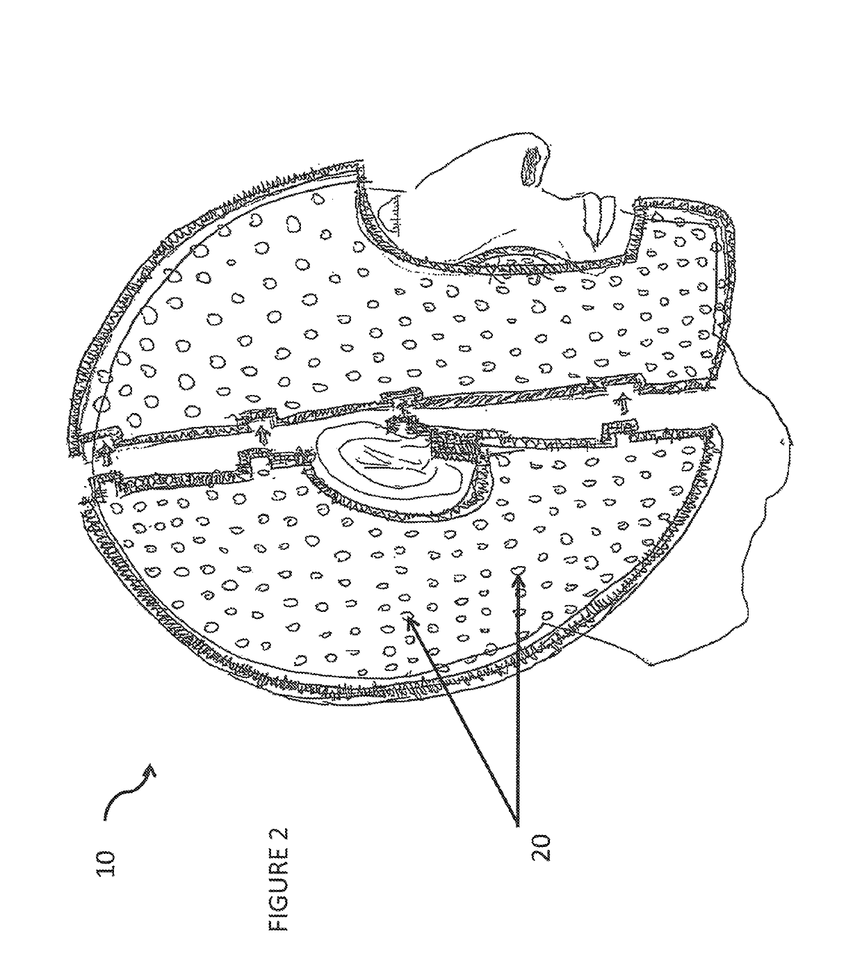 Total contact helmet