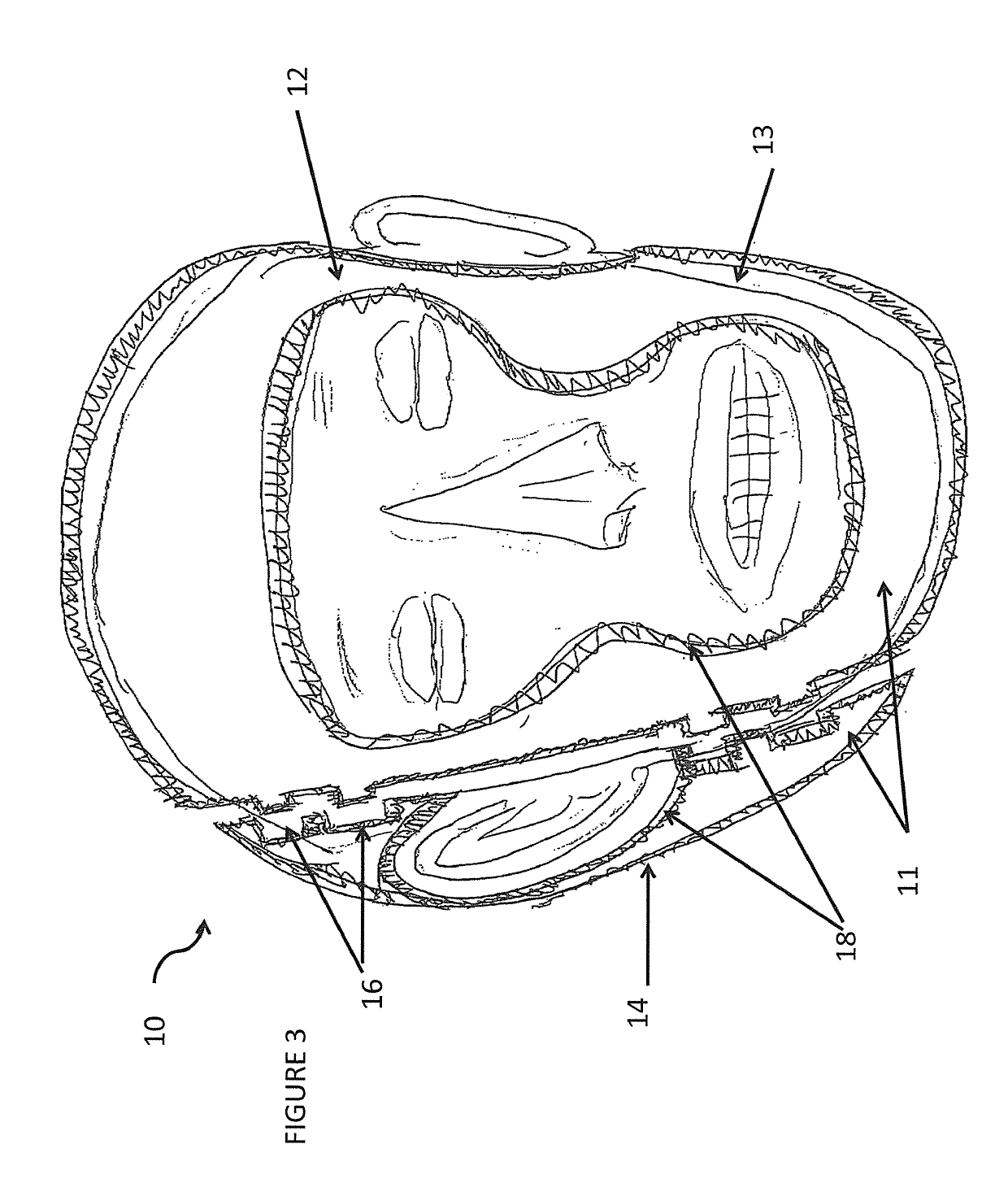 Total contact helmet