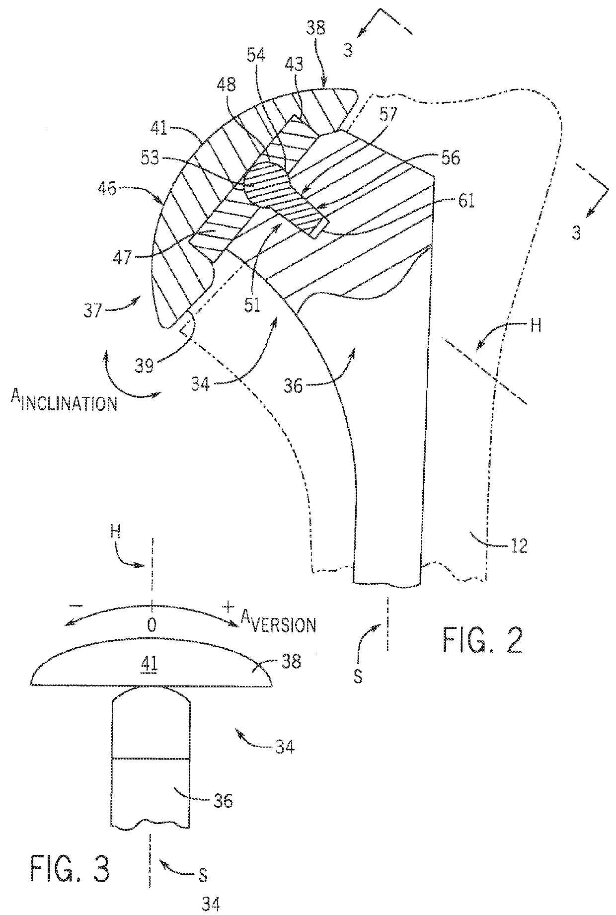 Shoulder prosthesis with variable inclination humeral head component