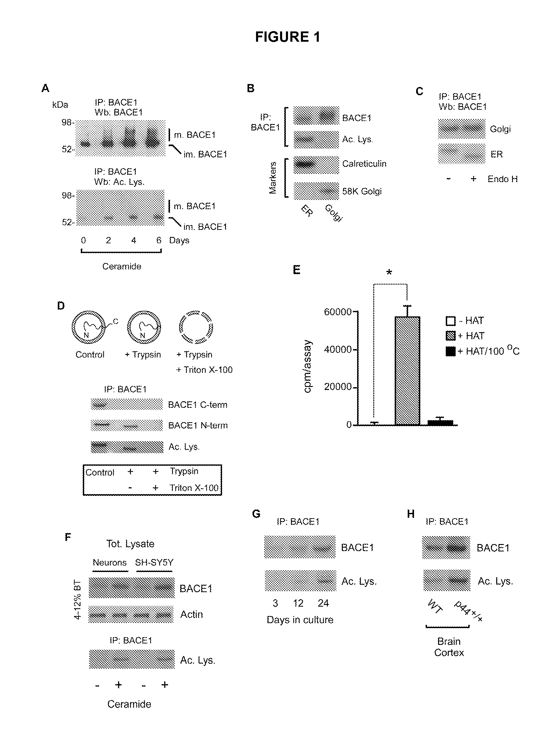 Identification of novel post-translational protein modifications