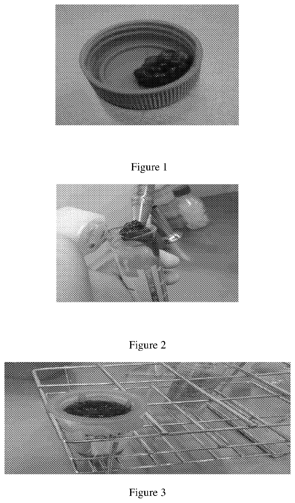 Osteoblast cell-mixture, and implementations thereof