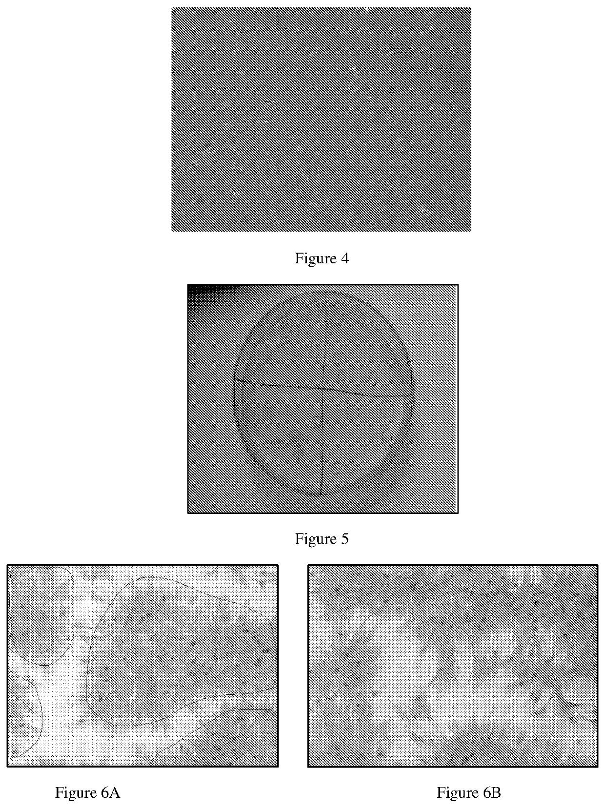 Osteoblast cell-mixture, and implementations thereof