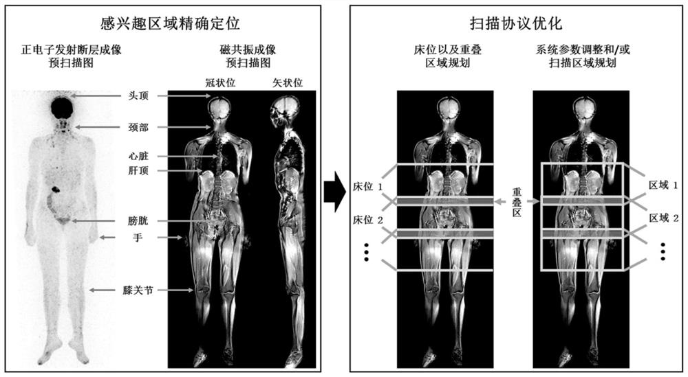 Automatic positioning method, device, equipment and medium for imaging scanning