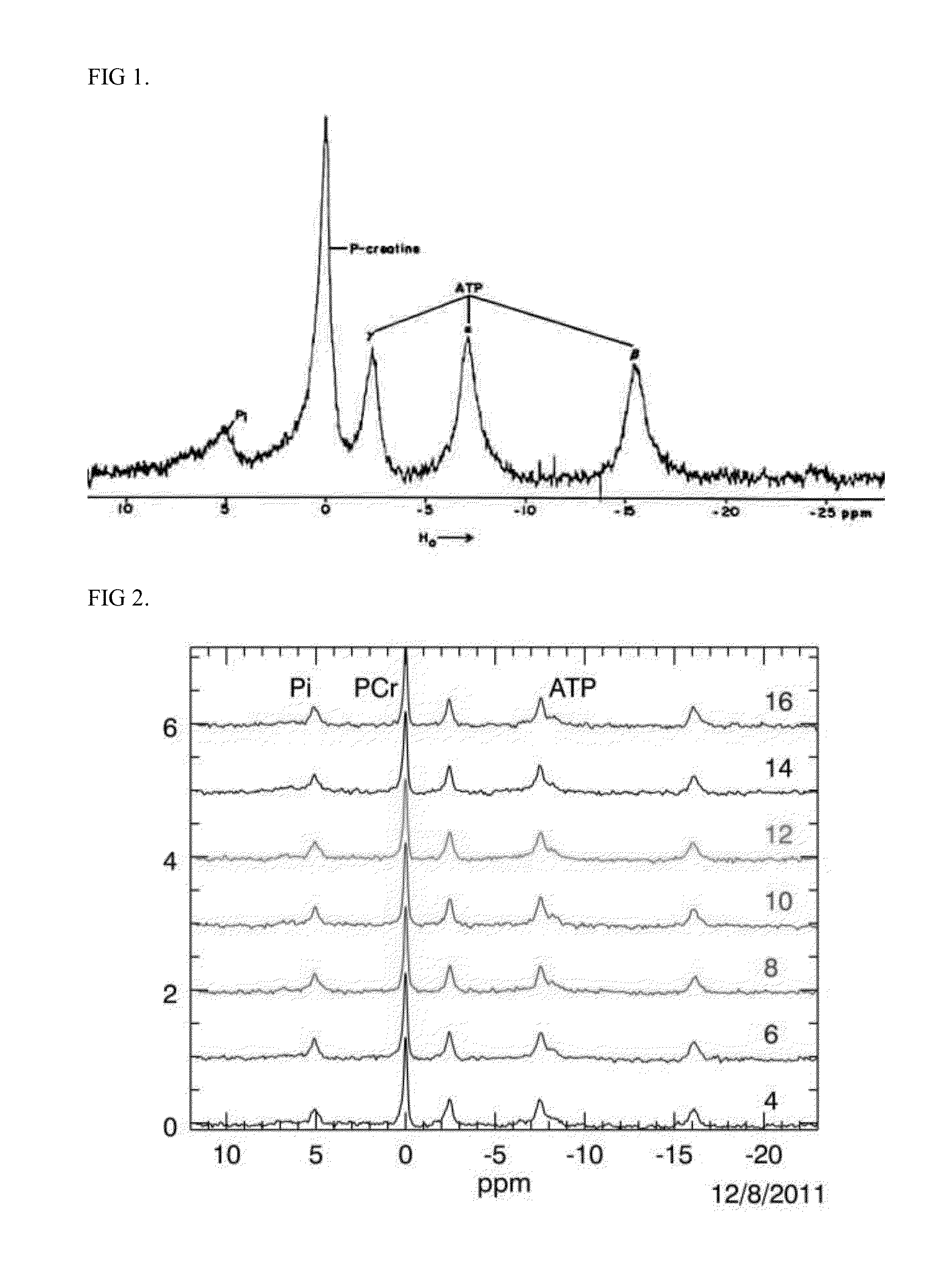 Use of 31p nmr spectroscopy of whole heart energetics for detection of drug-induced cardiotoxicity