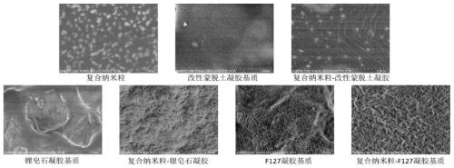 Vagina gel preparation and preparation method thereof