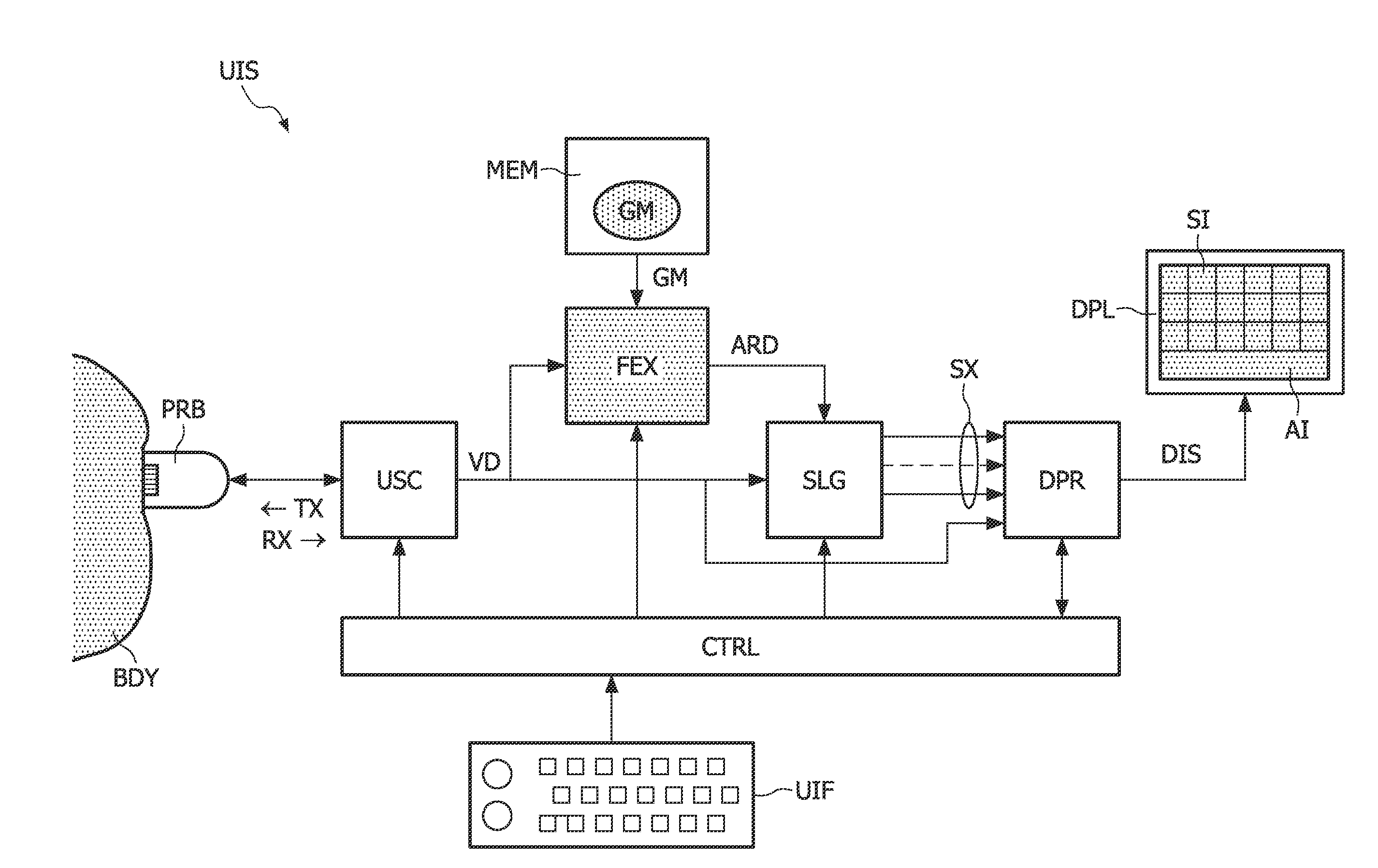 3-d ultrasound imaging