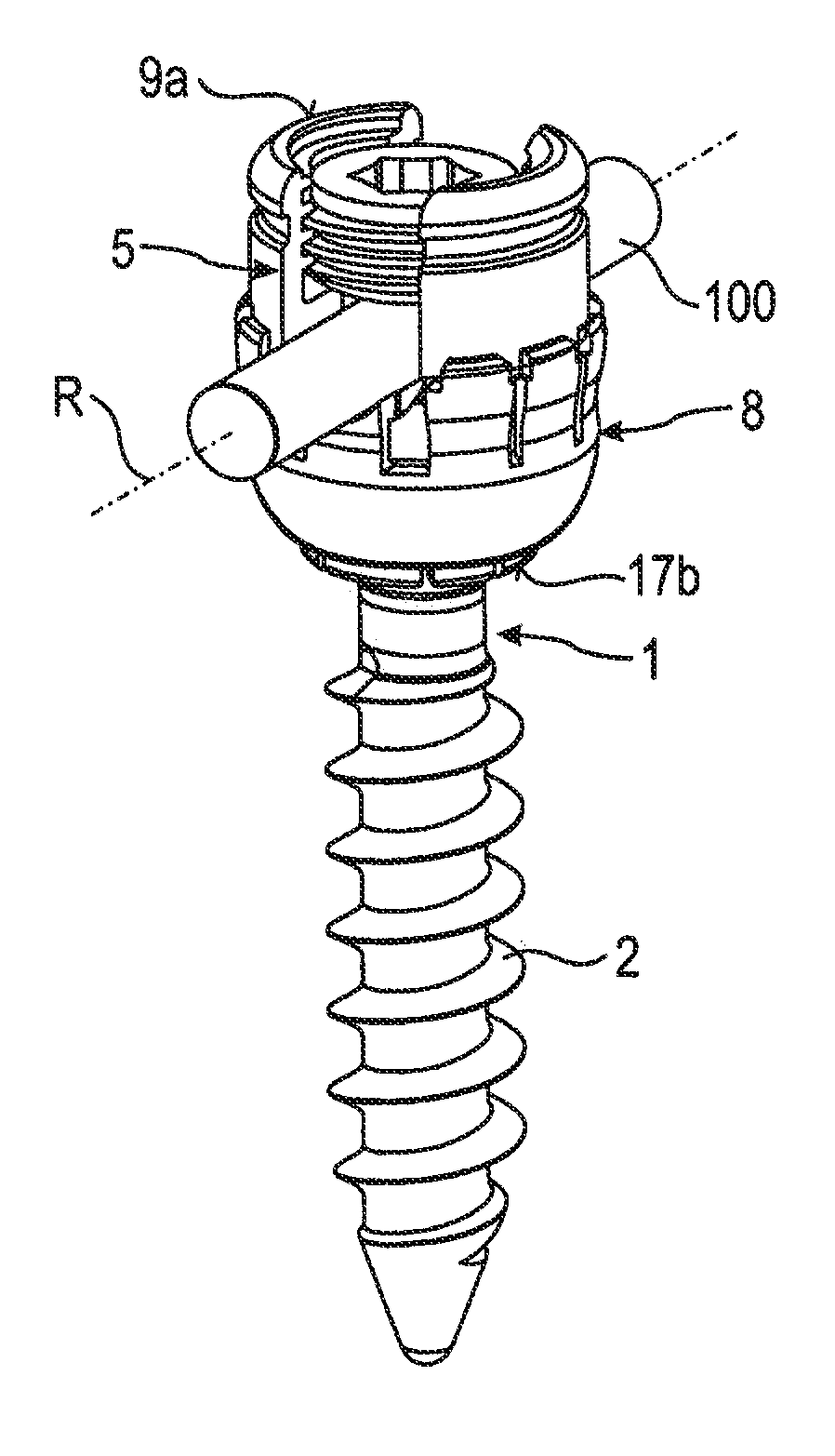 Stabilization device for stabilizing vertebrae or bone parts