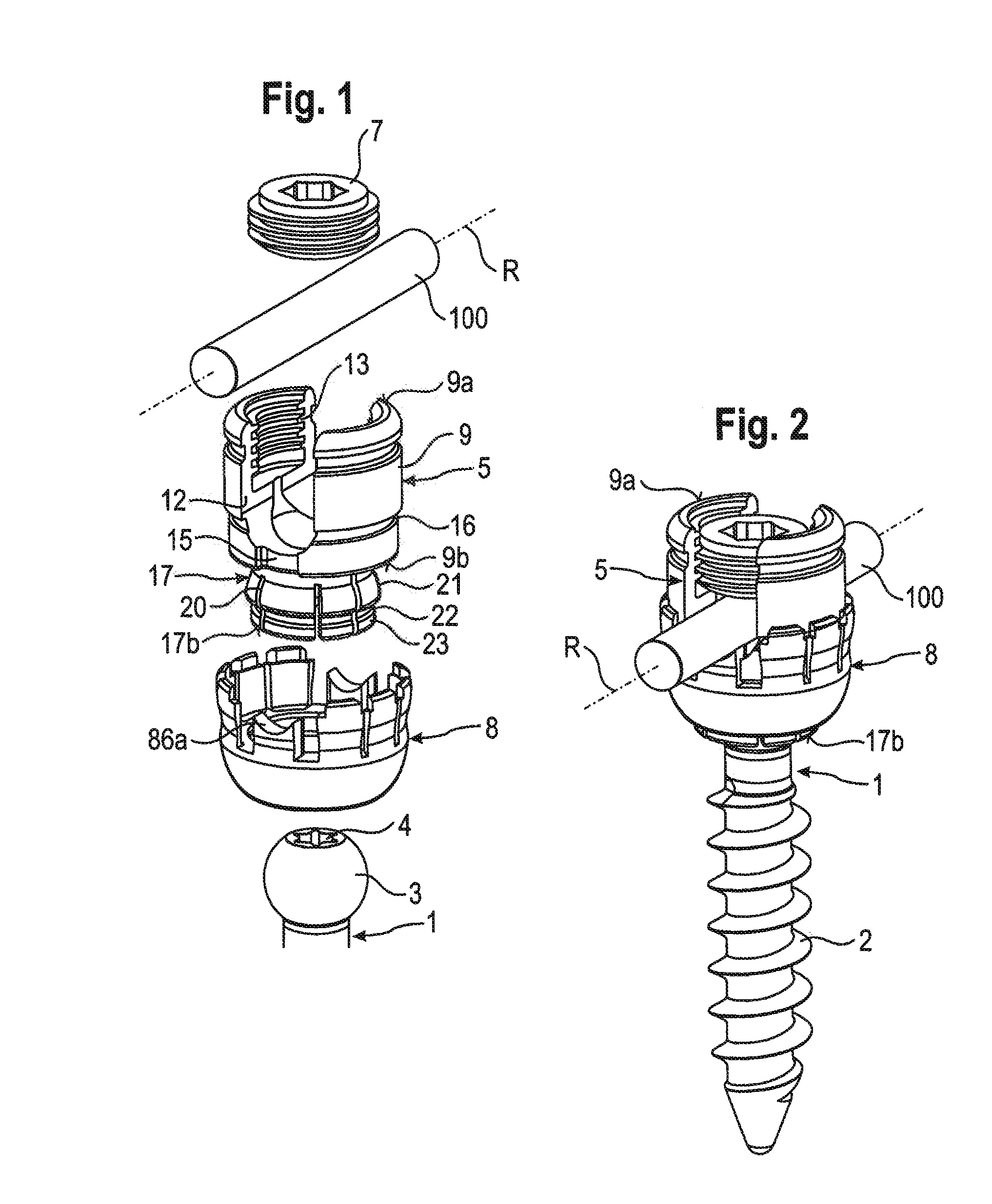 Stabilization device for stabilizing vertebrae or bone parts