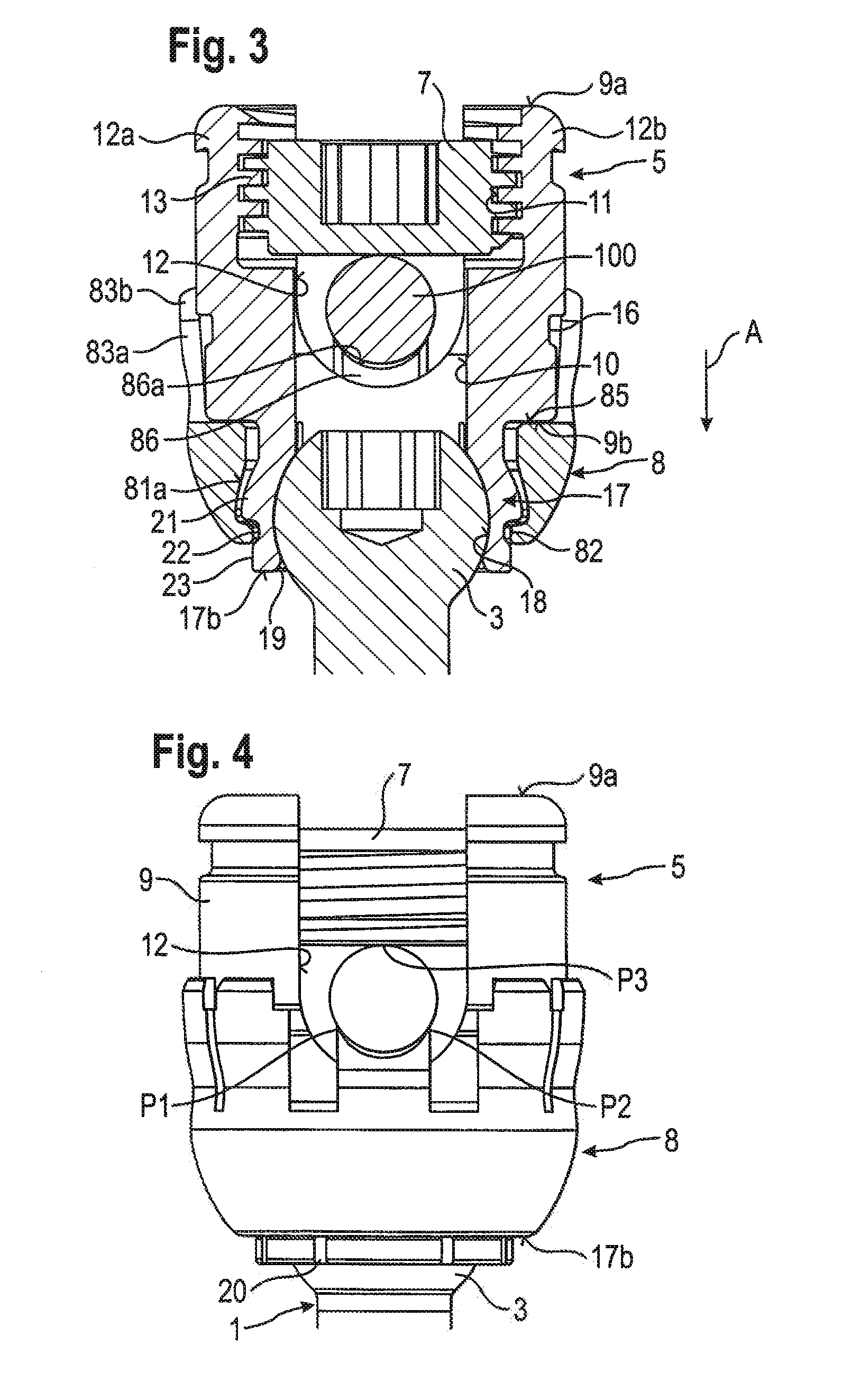 Stabilization device for stabilizing vertebrae or bone parts