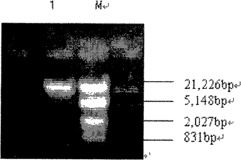 Saliva streptococcus 57.I urase gene and its urase