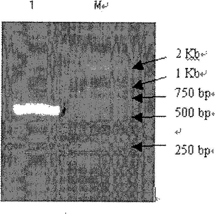 Saliva streptococcus 57.I urase gene and its urase