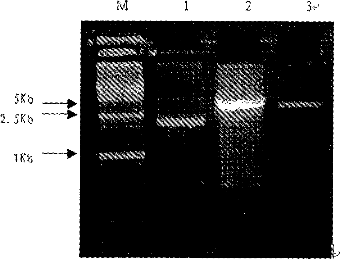 Saliva streptococcus 57.I urase gene and its urase