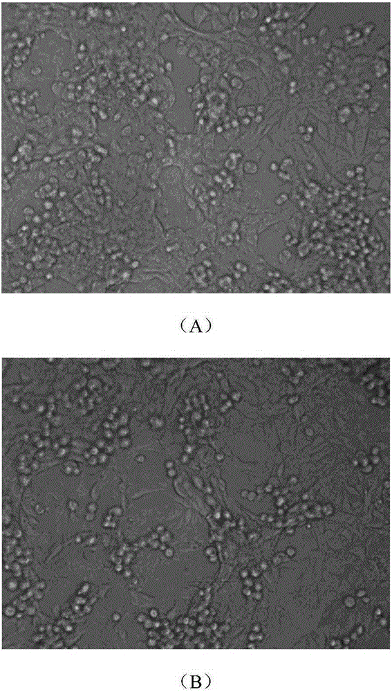 Chitosan-polypeptide complex for health product preparation and preparation method thereof