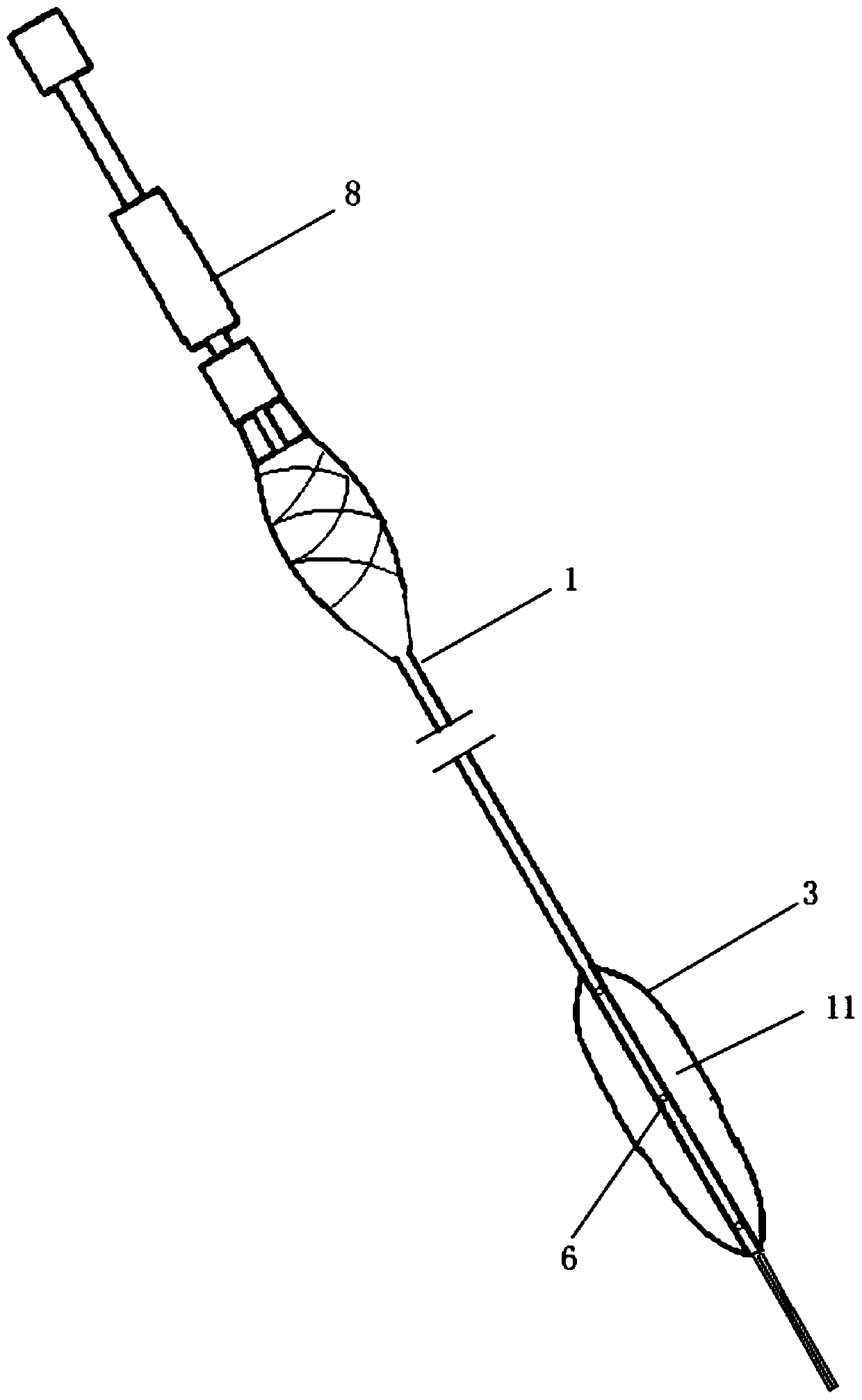 An occluder for ureteroscopic lithotripsy