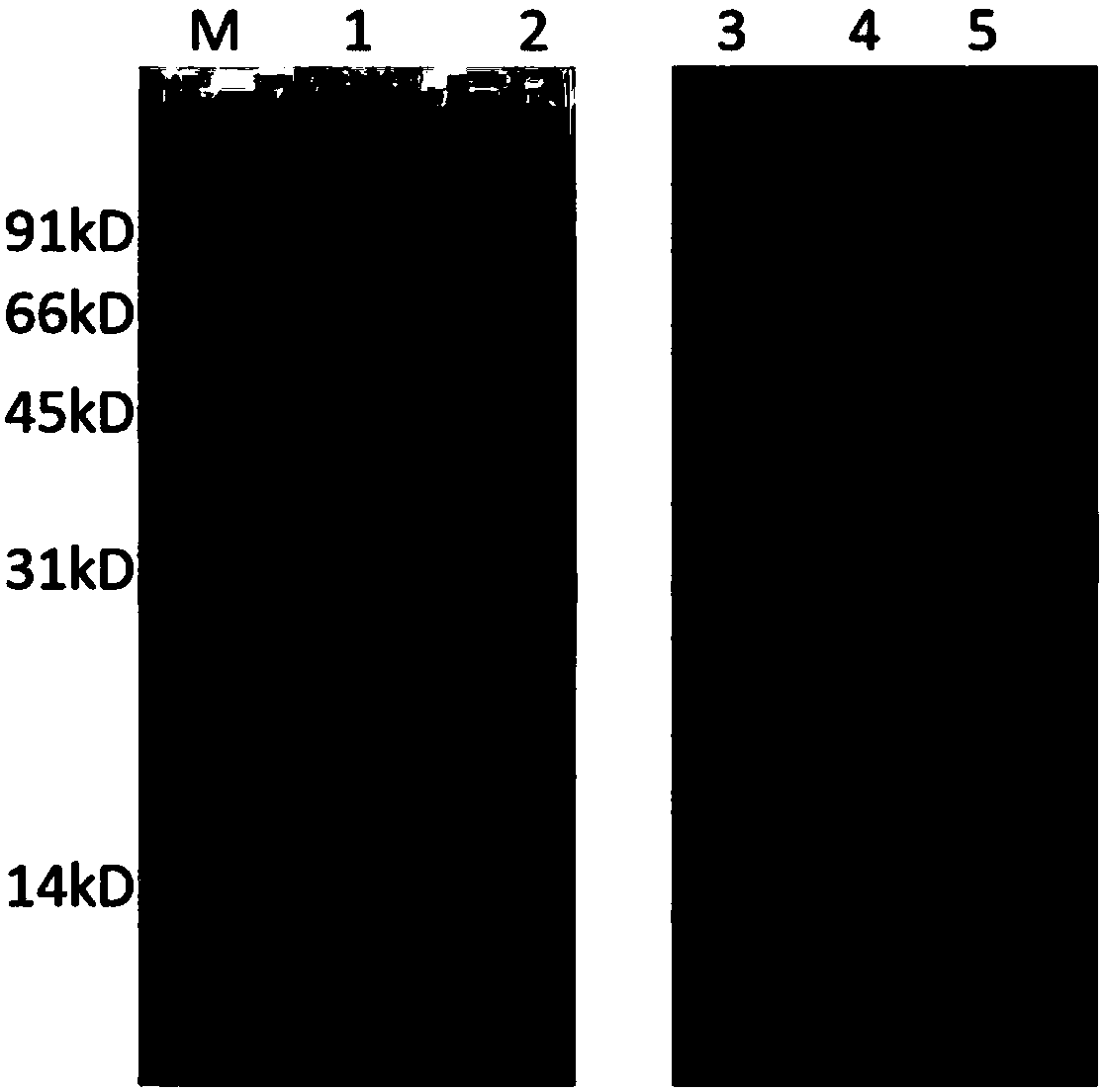 Nucleotide sequence and expression vector of encoded recombinant urate oxidase protein