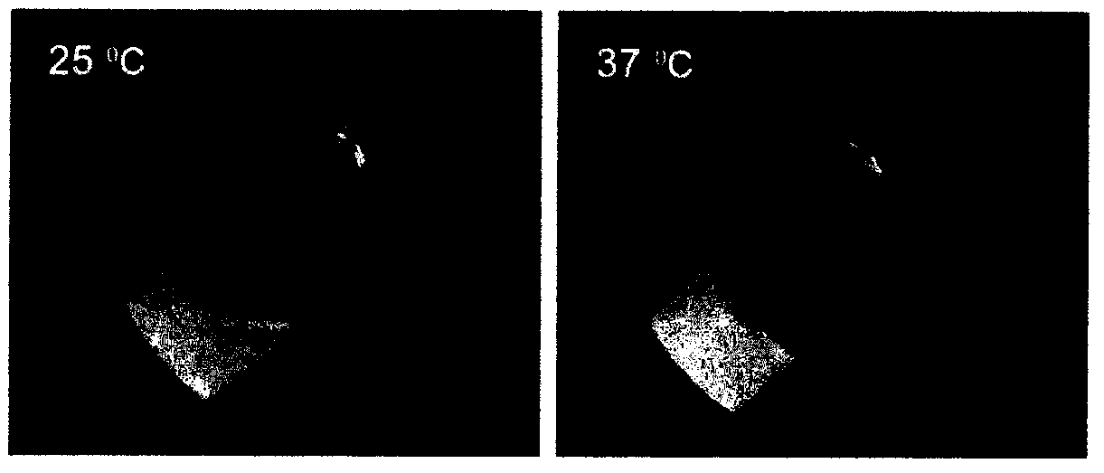 Polyester-polyether temperature-sensitive gel with slow release of batimastat and preparation method thereof