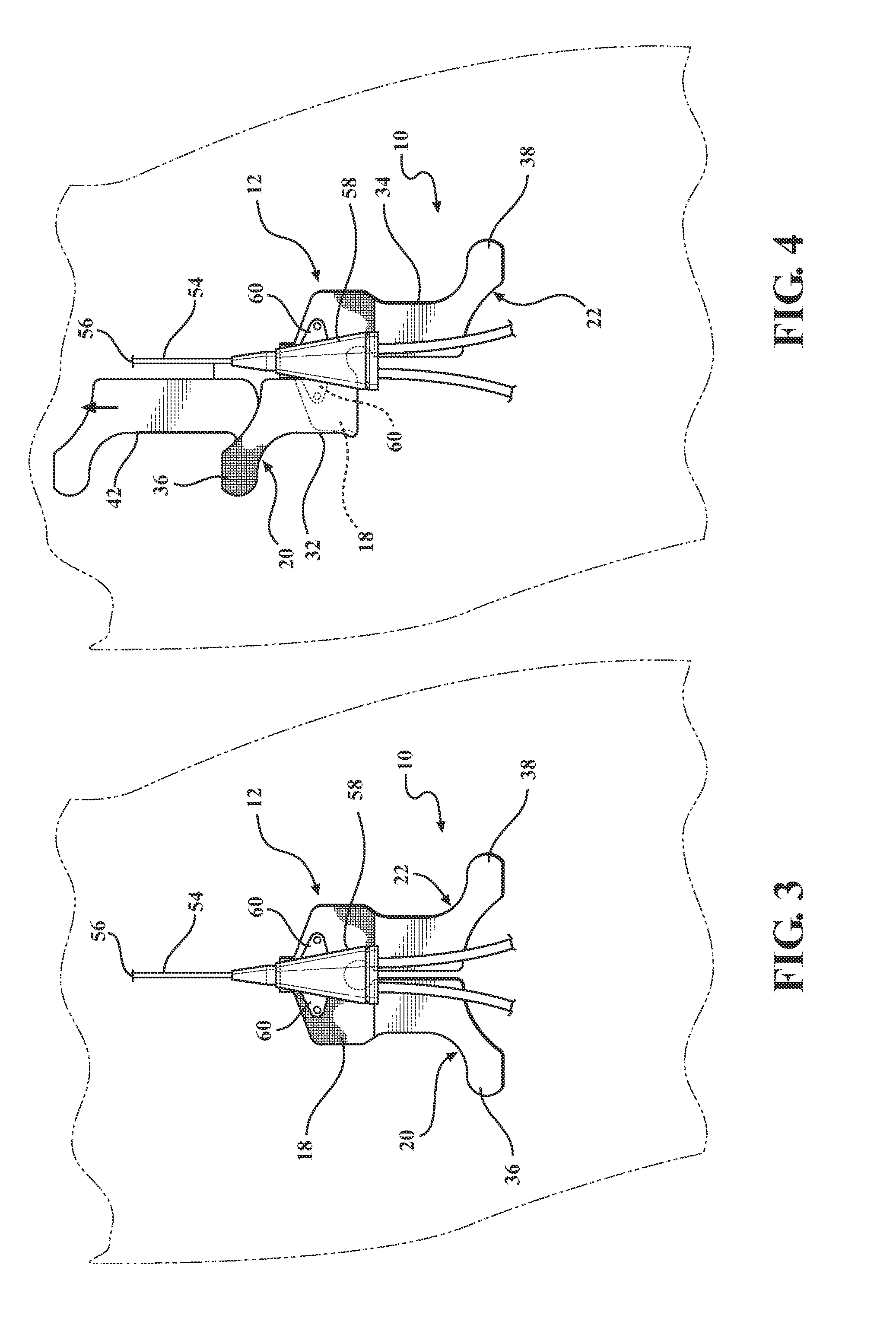 Catheter securement device to secure silicone winged piccs