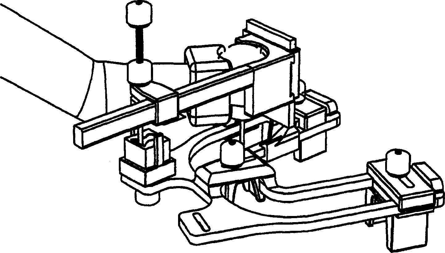 Method and apparatus for tooth treatment