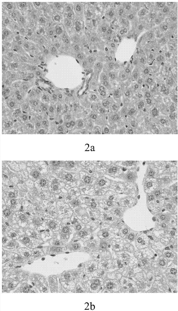 Construction method and application of diet-induced insulin resistance model