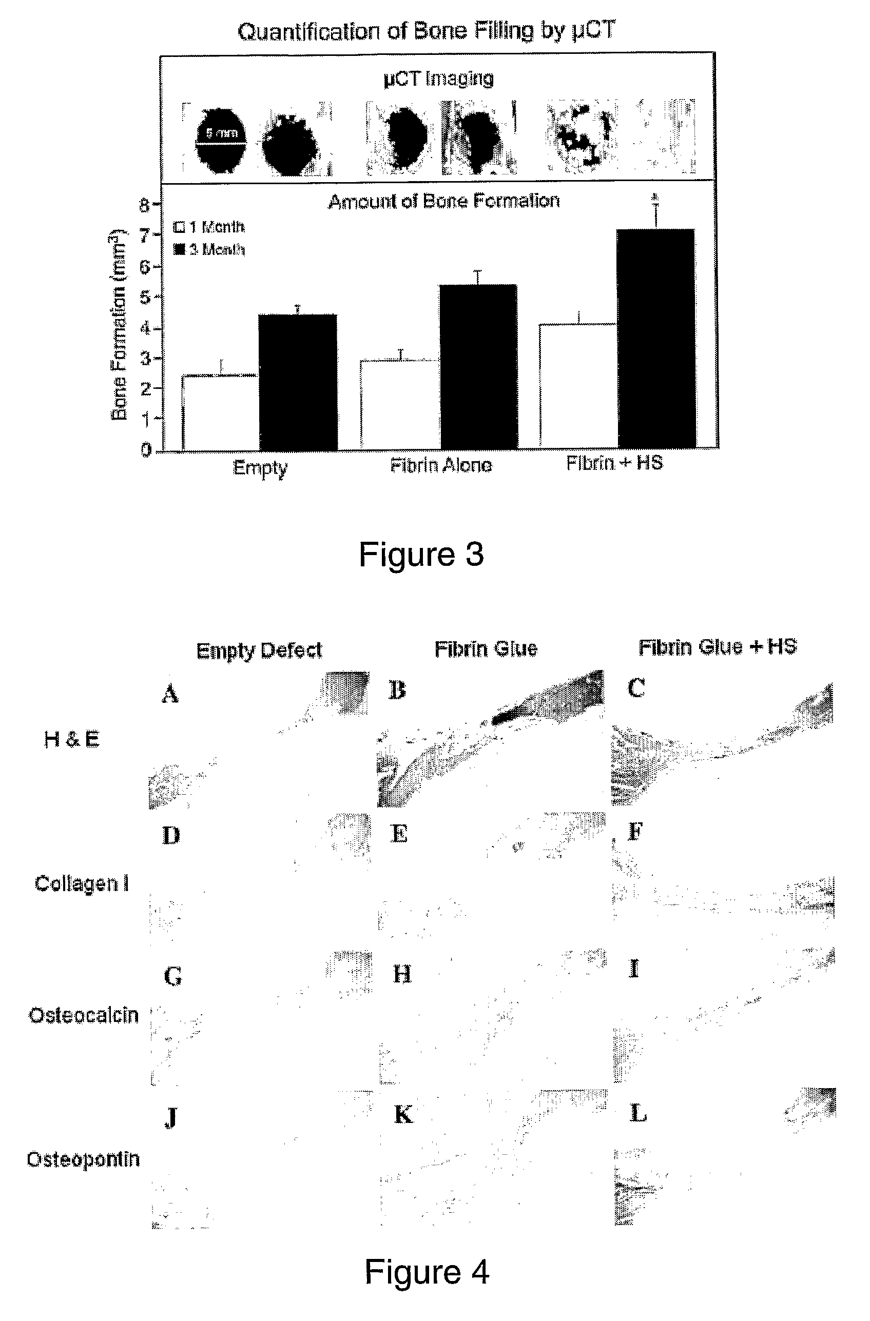 Therapeutic bone growth and regeneration