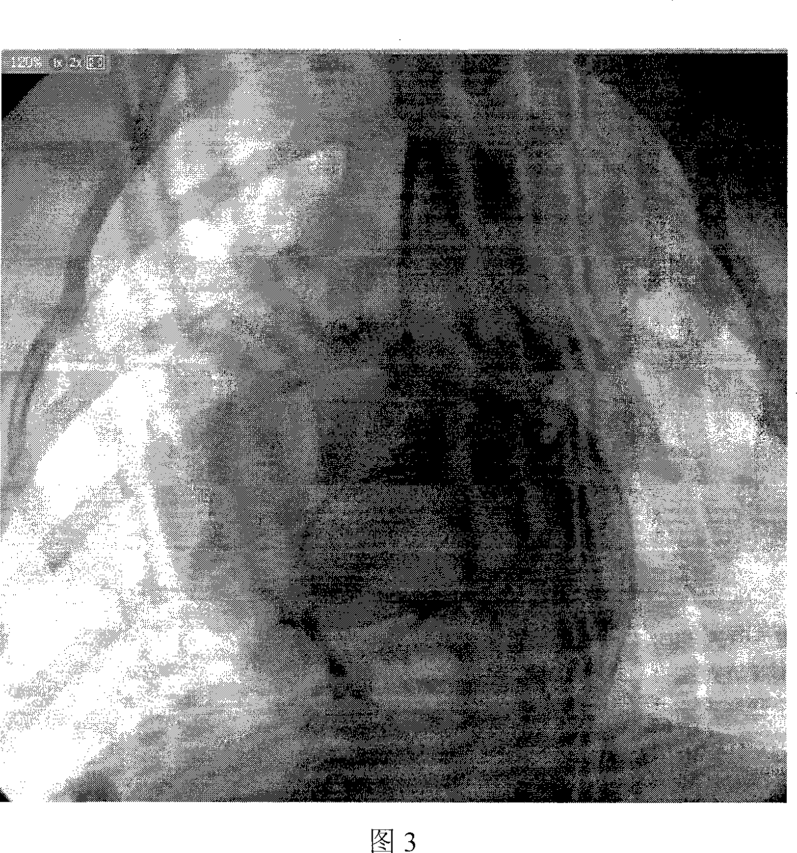 Establishing beagle dog myocardial infarction model using polythene foam plugging method