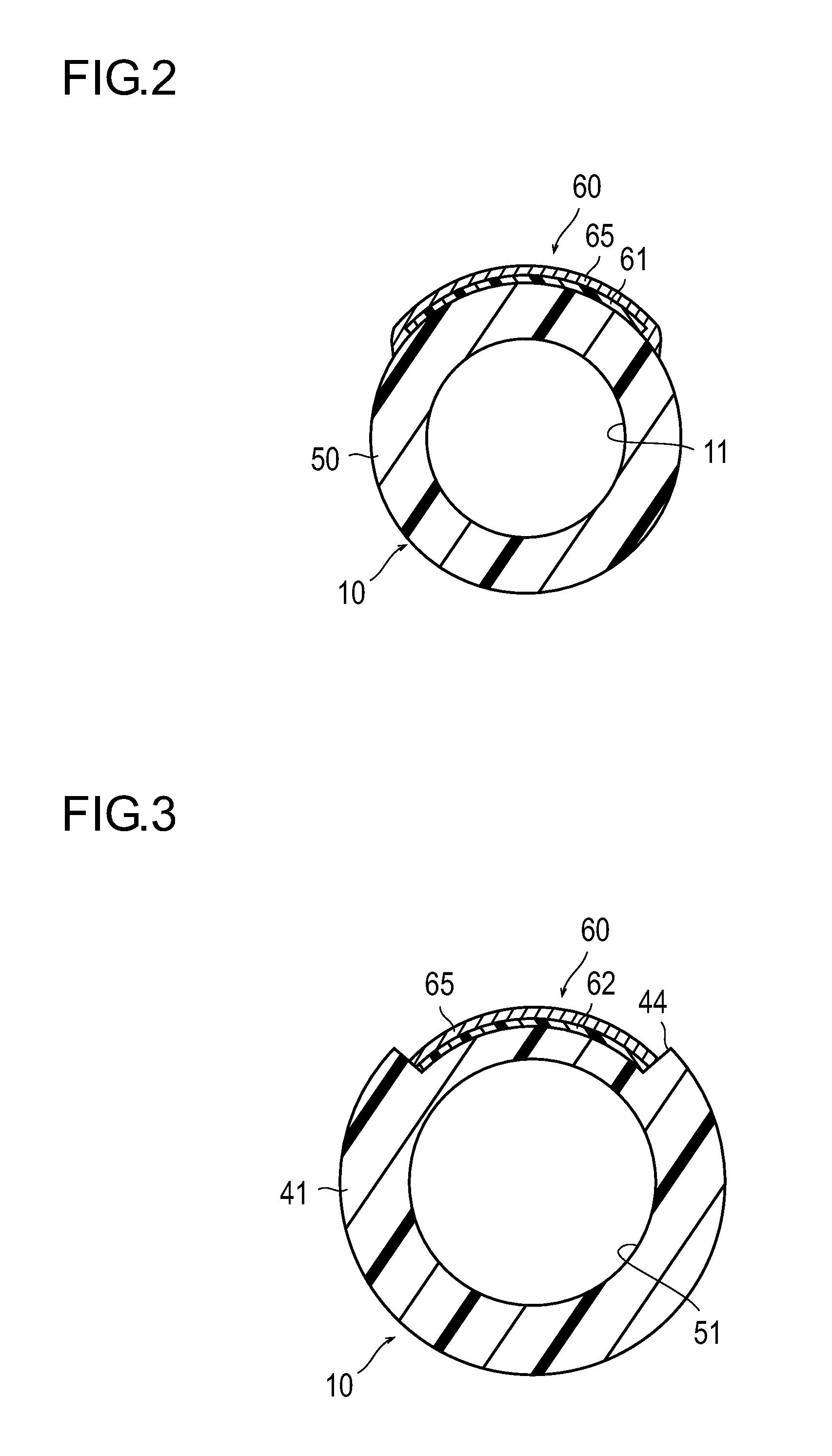 Catheter