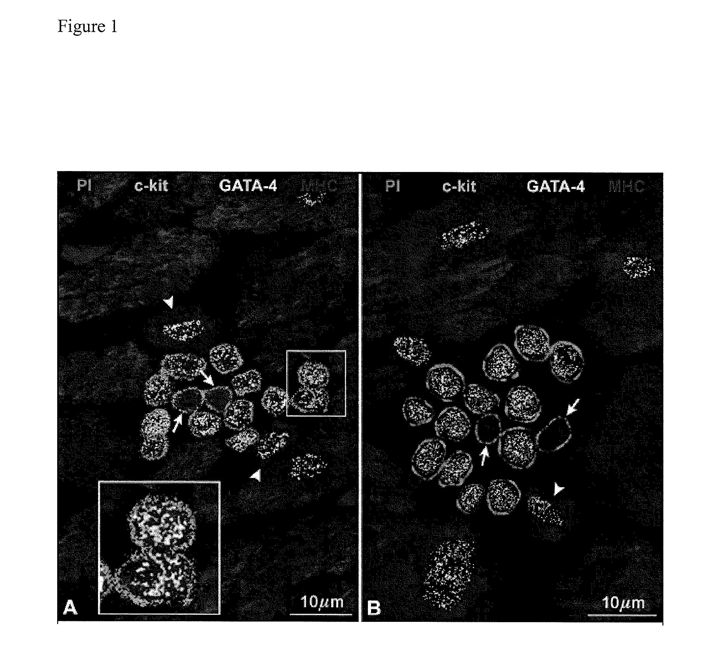 Methods of isolating non-senescent cardiac stem cells and uses thereof