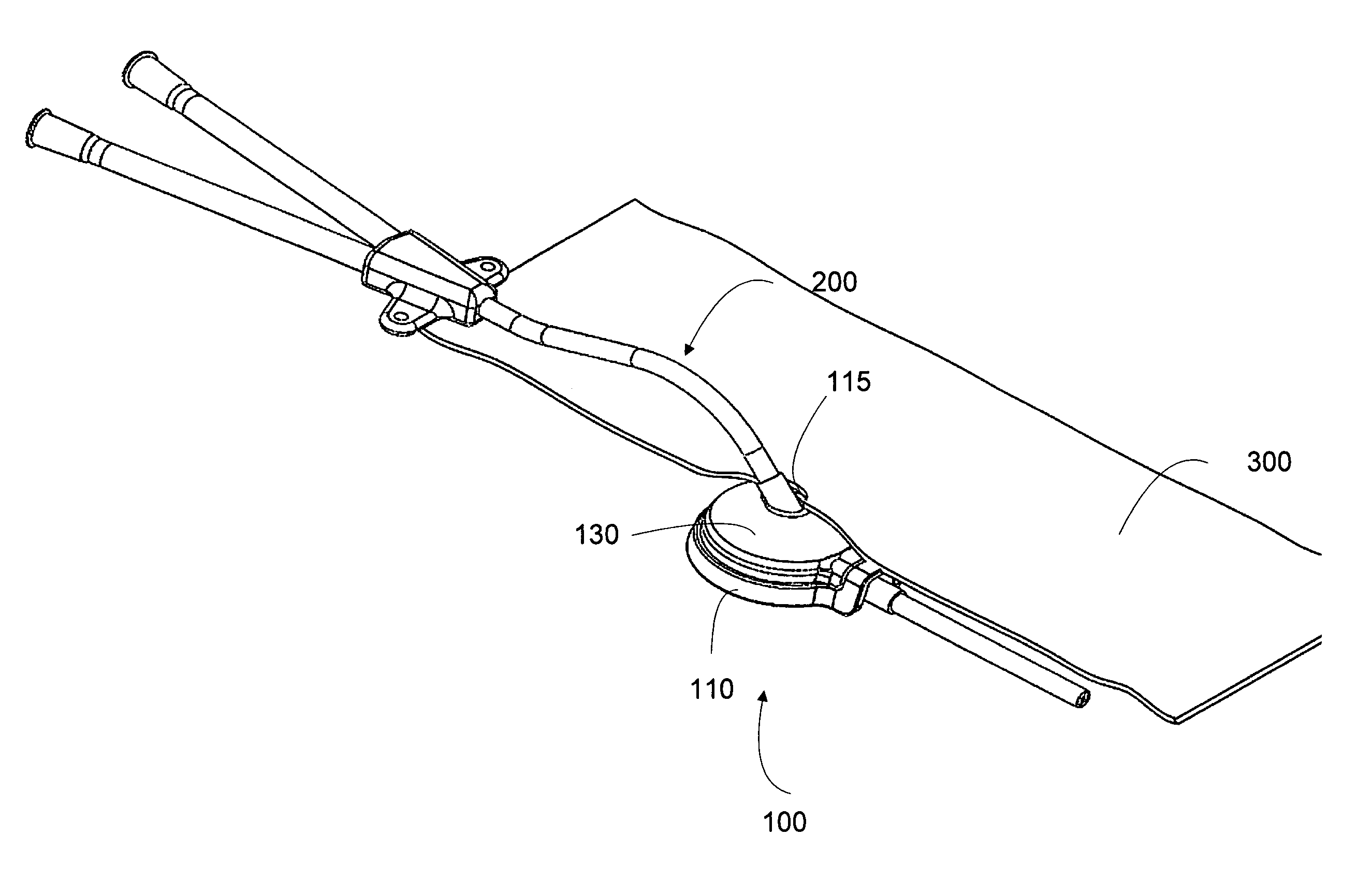 Deformable medical implant