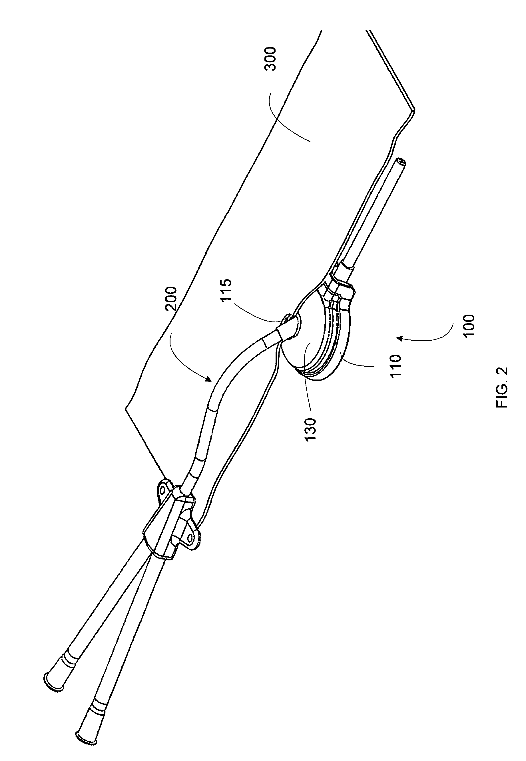 Deformable medical implant