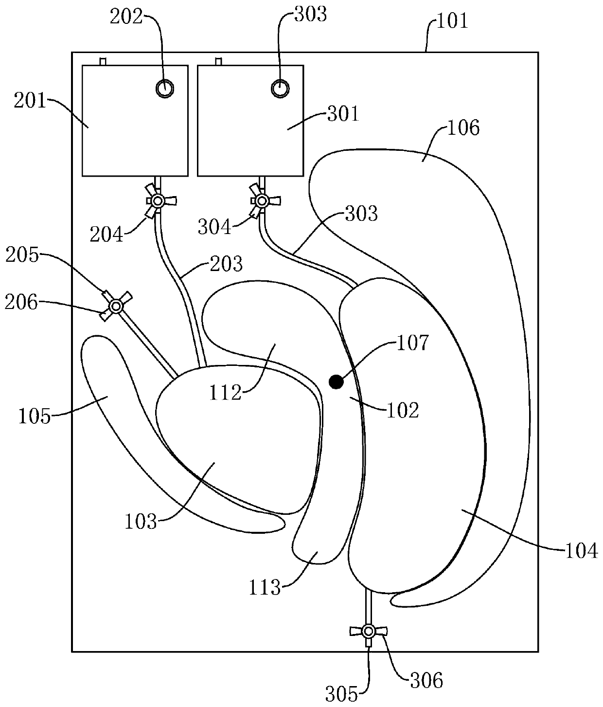 Demonstration and education system for female pelvic tumor patients