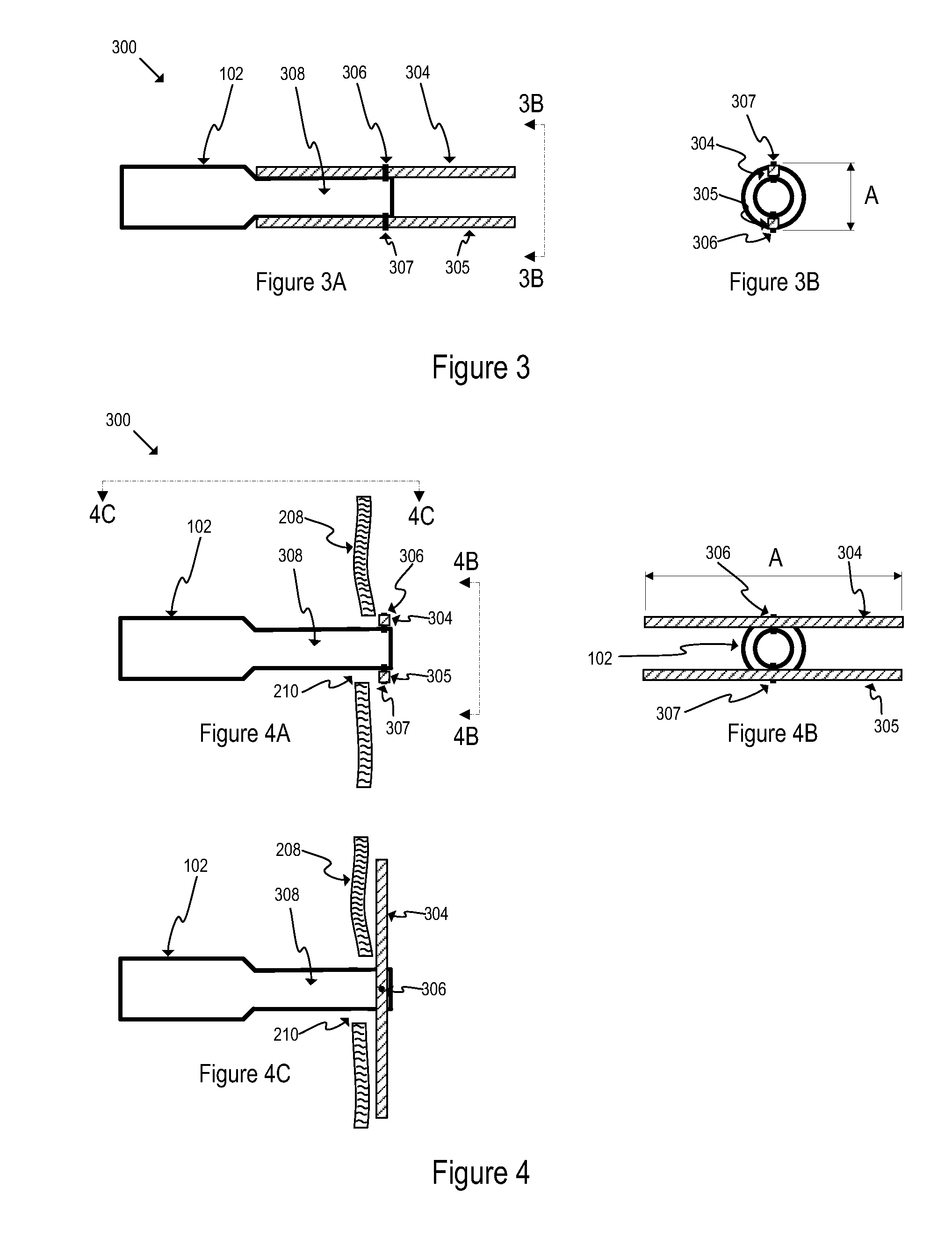 T-shaped gastrostomy tube retention device