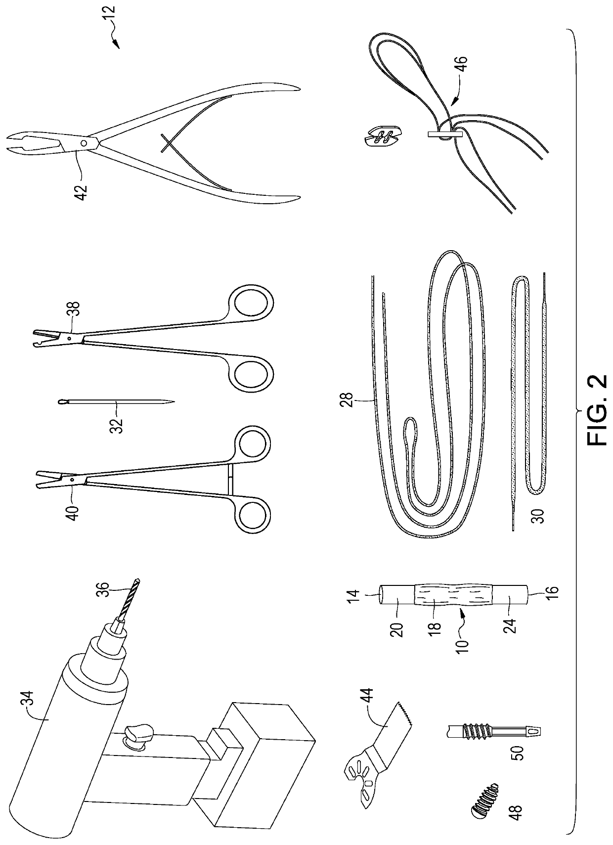 Patellar tendon graft and anterior cruciate ligament (ACL) reconstruction method using suture tape augmentation