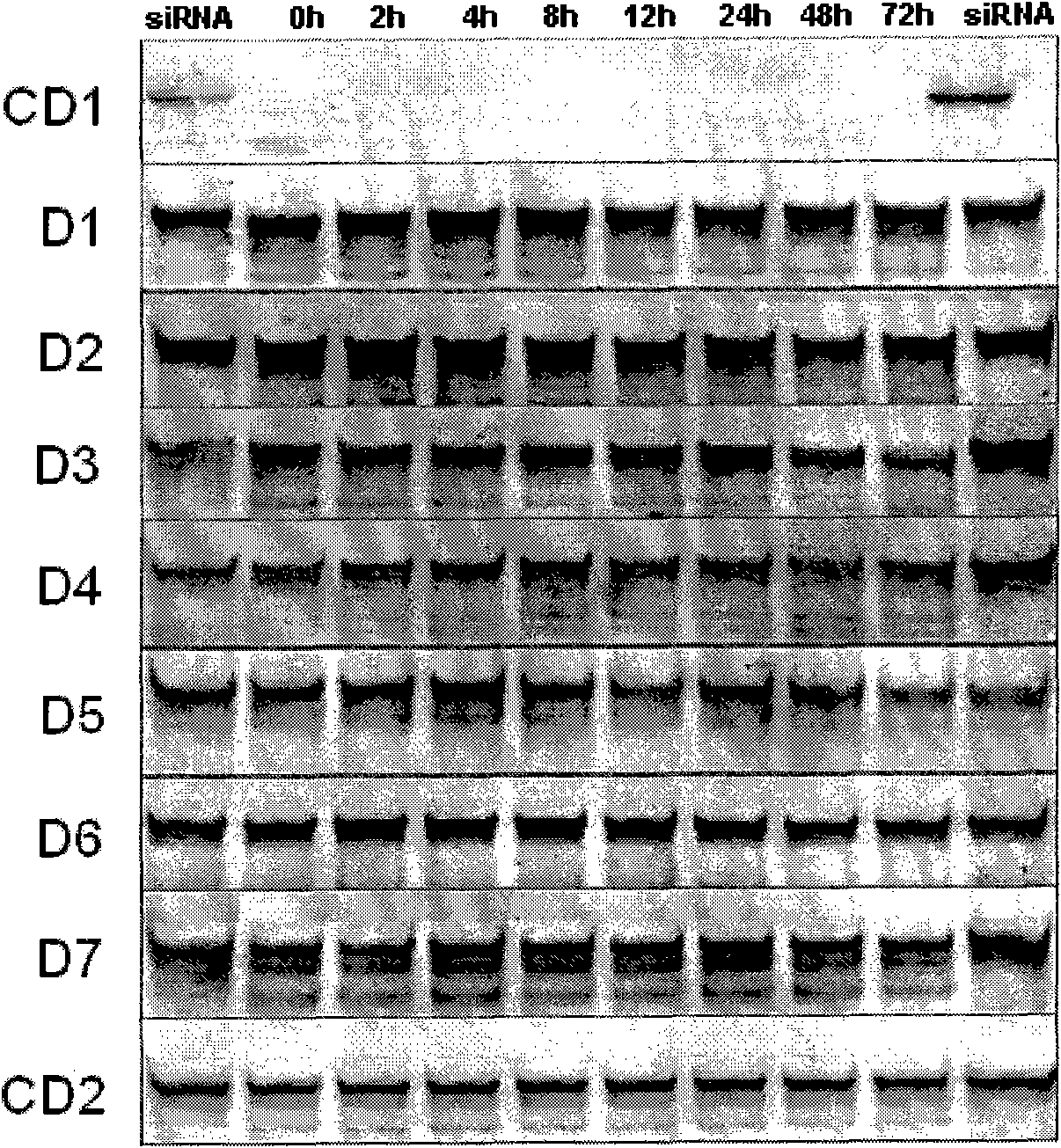 SiRNA (Small interference ribonucleic acid) as well as medicine composition and pharmaceutical application thereof