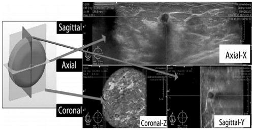 Automatic splicing method and system for ABUS mammary gland ultrasonic panorama and storage medium