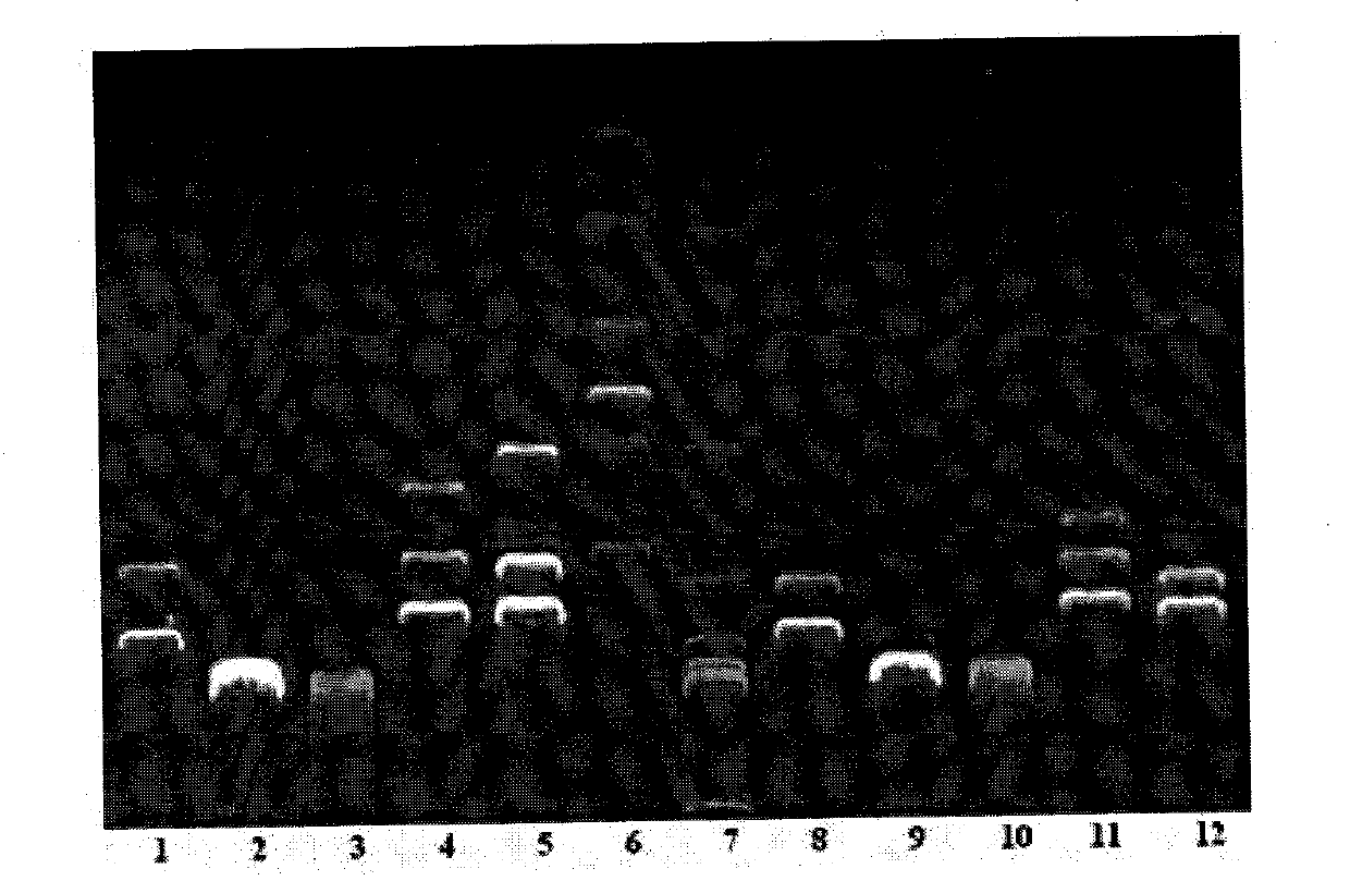 Recombinant plasmid vaccine for treating hepatitis B and composition thereof