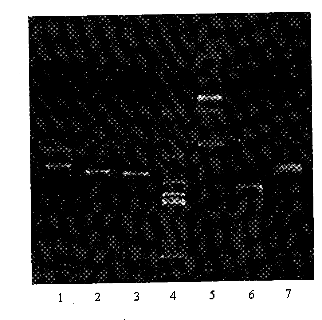 Recombinant plasmid vaccine for treating hepatitis B and composition thereof