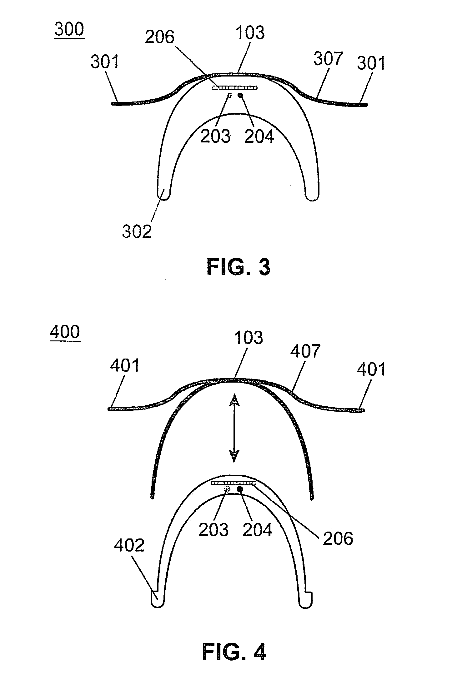 Spectacle frame bridge housing electronics for electro-active spectacle lenses