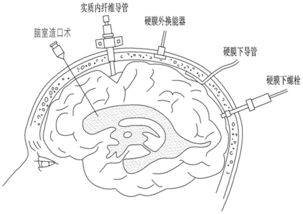 brain pressure measuring device