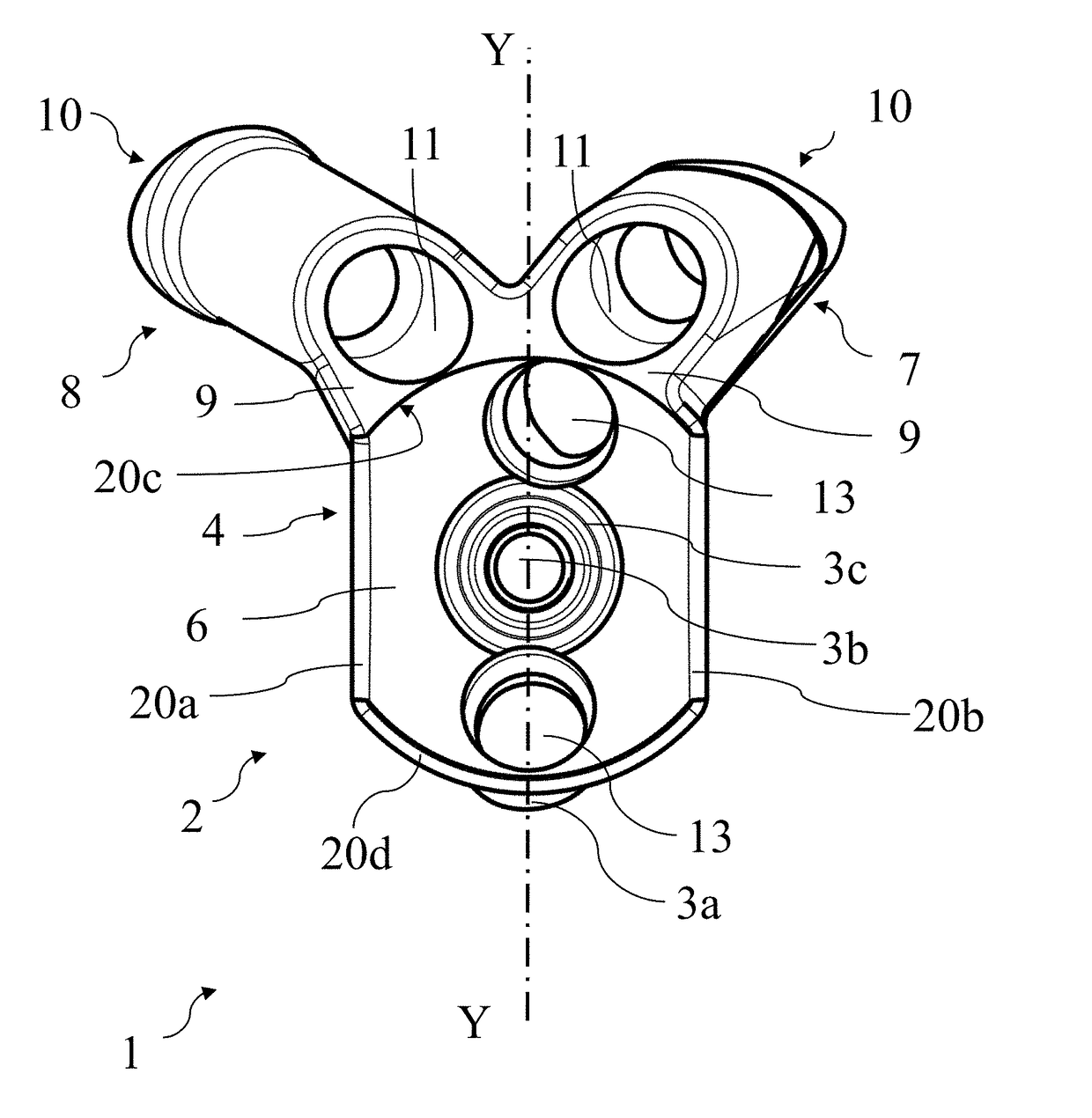 Scapular anchor for fixing a glenoid component of a shoulder joint prosthesis to a scapula with compromised anatomy and related method for manufacturing said scapular anchor