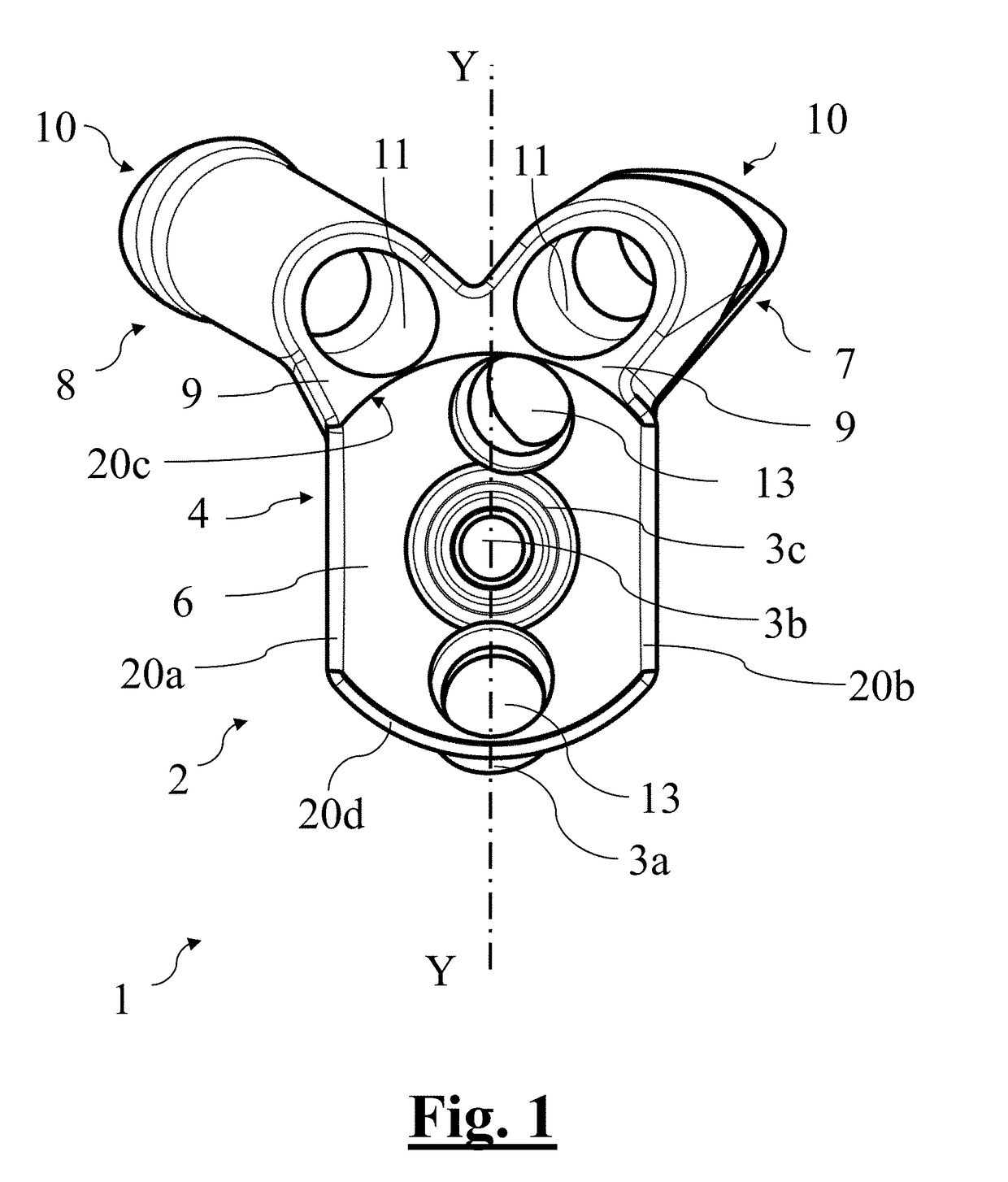 Scapular anchor for fixing a glenoid component of a shoulder joint prosthesis to a scapula with compromised anatomy and related method for manufacturing said scapular anchor