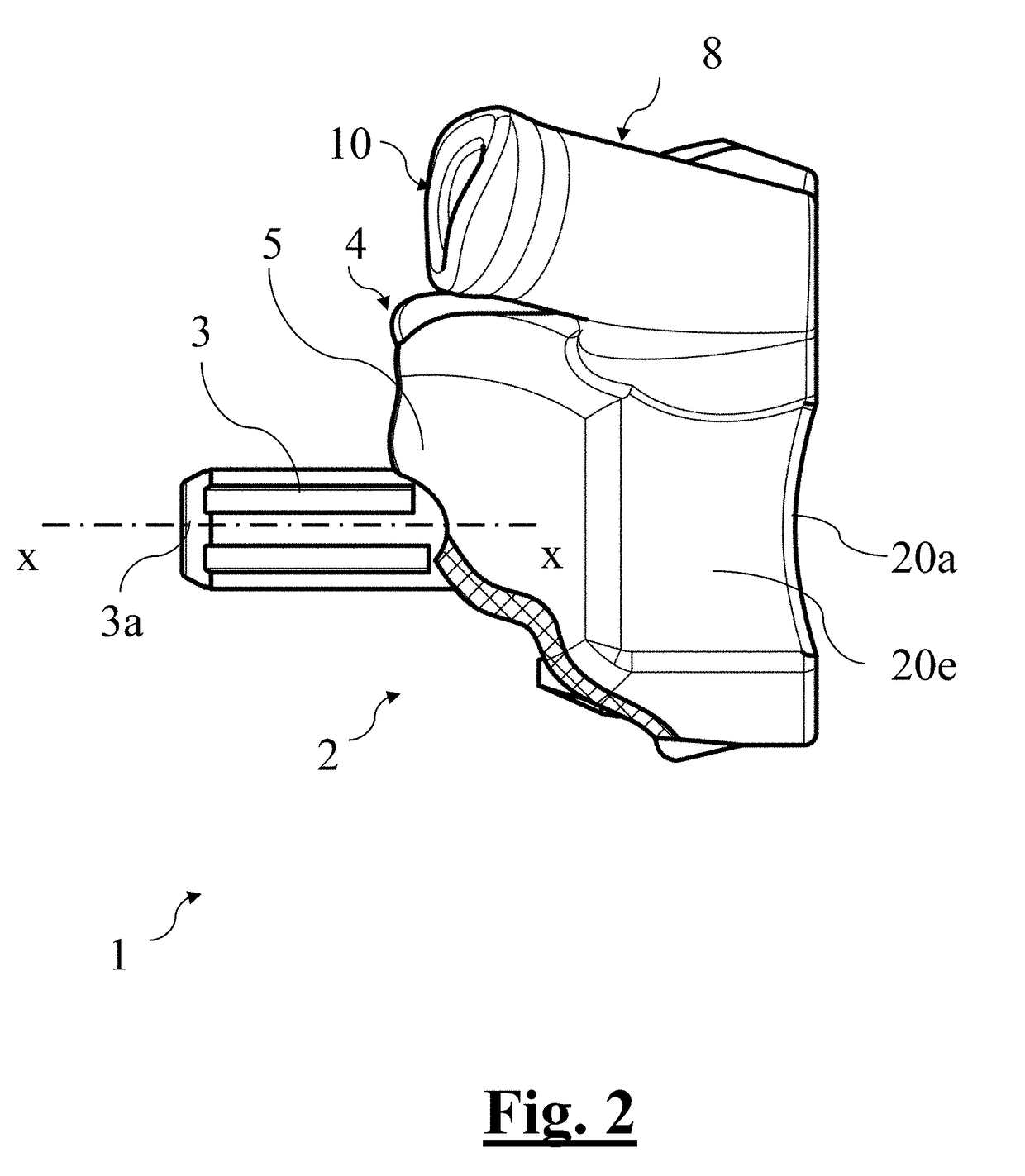 Scapular anchor for fixing a glenoid component of a shoulder joint prosthesis to a scapula with compromised anatomy and related method for manufacturing said scapular anchor