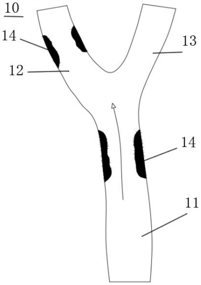 Covered stent