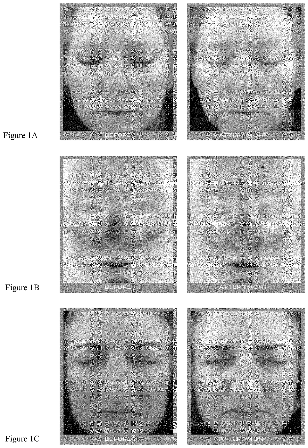 Cosmetic formulation to reduce facial flushing