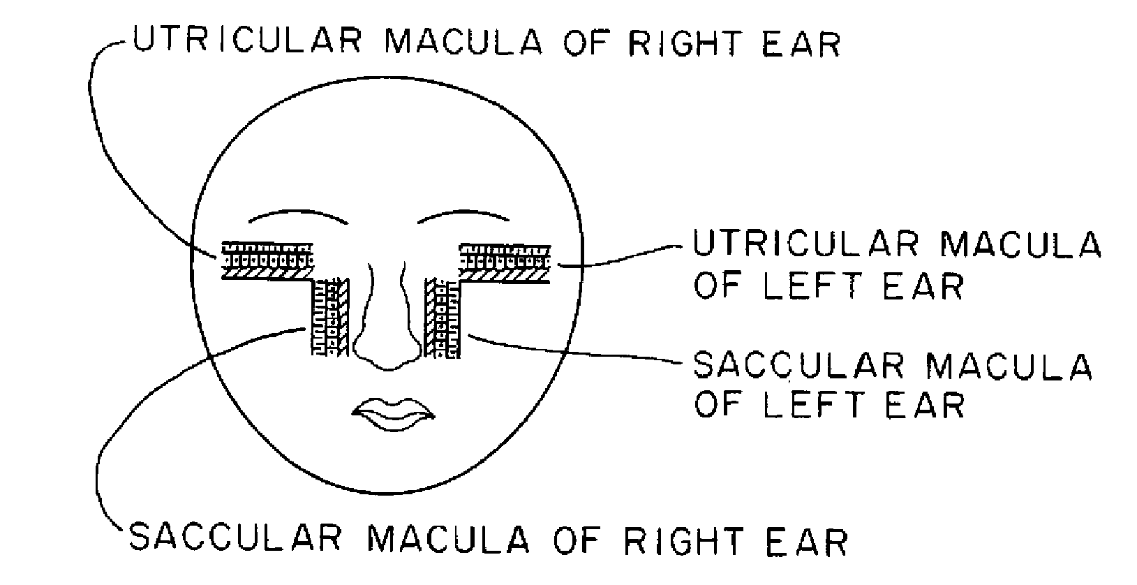 Methods and apparatuses for stimulating otolith organs by linear acceleration