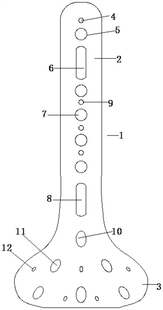 Posterior ankle bone fracture plate