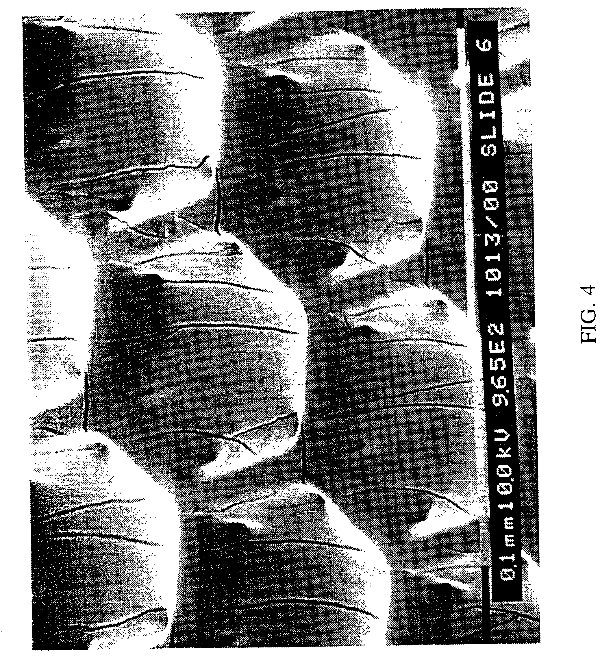 Bucky paper as a support membrane in retinal cell transplantation