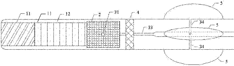 Gradient array ultrasonic imaging guidance ablation catheter